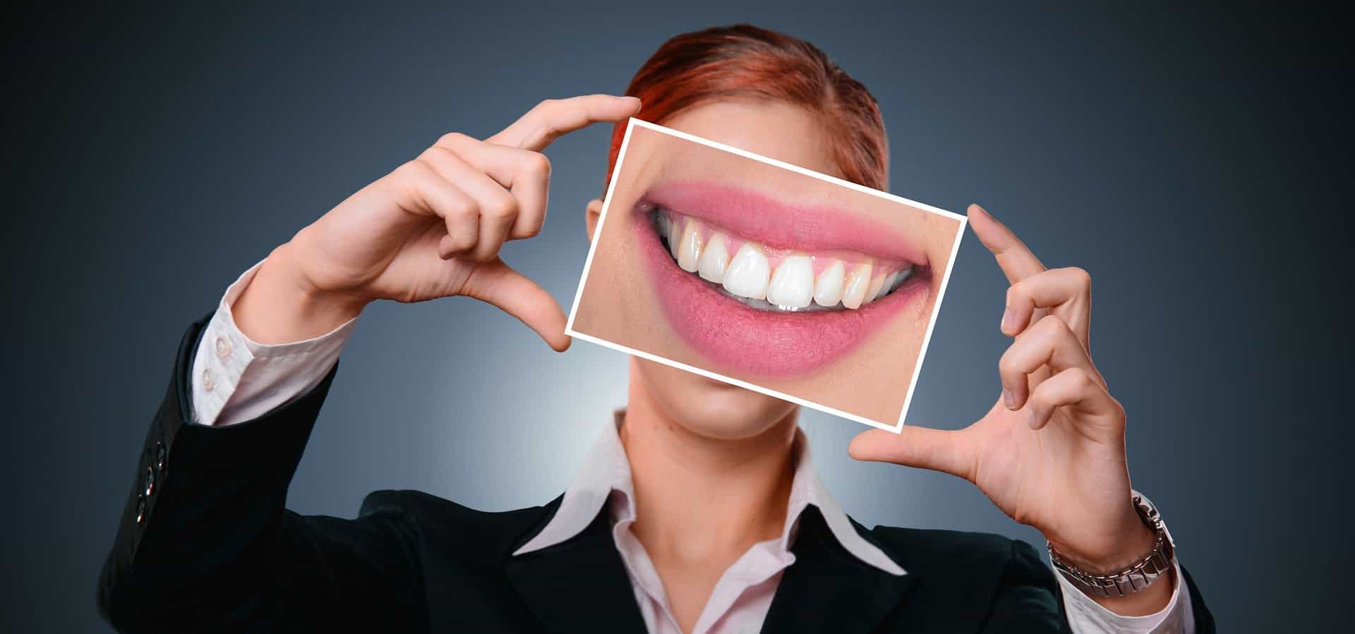 Invisalign Milano tipo di prodotto
